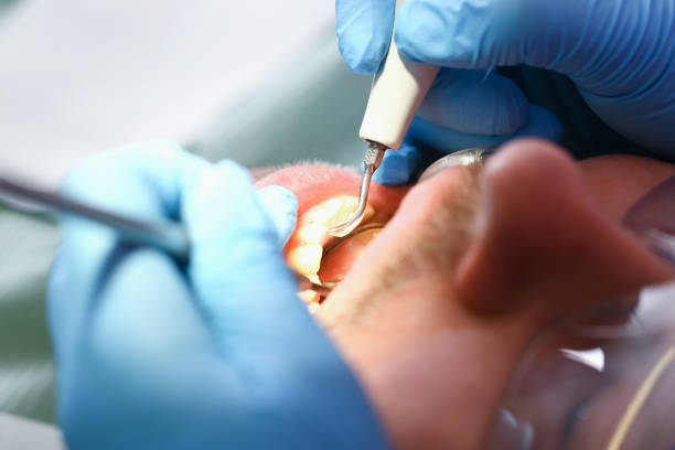 Best Broken or Cracked Tooth Emergency Dentist in Carthage, MO