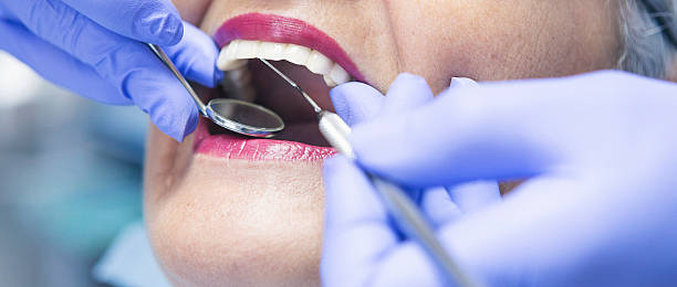 Best Emergency Root Canal Treatment in Carthage, MO